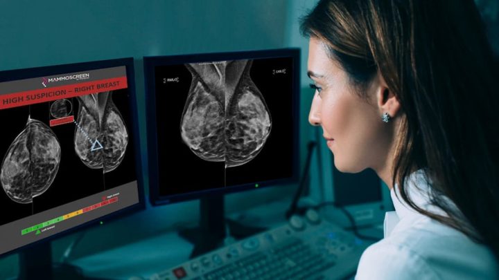MammoScreen : Le nouvel appareil pour diagnostiquer le cancer du sein