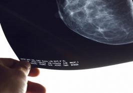 MammoScreen : Le nouvel appareil pour diagnostiquer le cancer du sein 80 MammoScreen: O novo dispositivo para diagnóstico de cancro da mama
