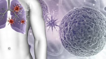 TLR2 : la protéine qui pourrait aider à réduire les décès par cancer