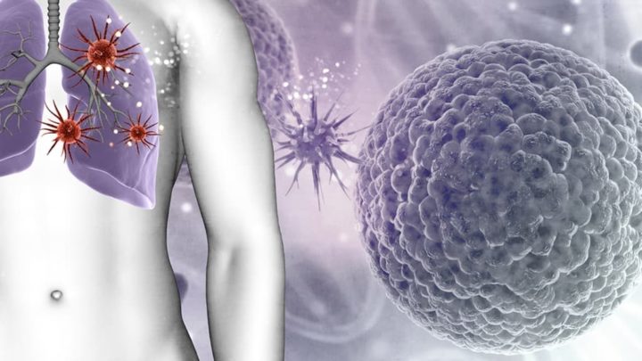 TLR2 : la protéine qui pourrait aider à réduire les décès par cancer 2 TLR2 la proteine qui pourrait aider a reduire les