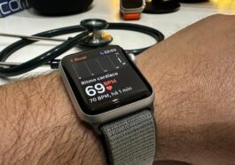 Apple Watch pourrait aider à prédire la douleur chez les personnes atteintes de drépanocytose