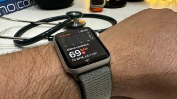 Apple Watch pourrait aider à prédire la douleur chez les personnes atteintes de drépanocytose