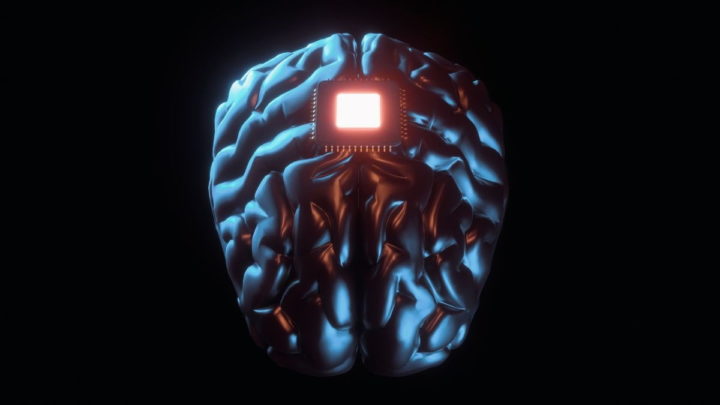 implant cérébral