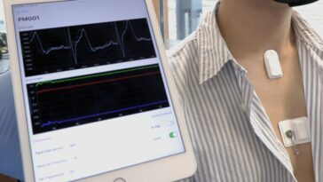 Monitorização em Tempo Real dos Sinais Vitais com sensores wireless