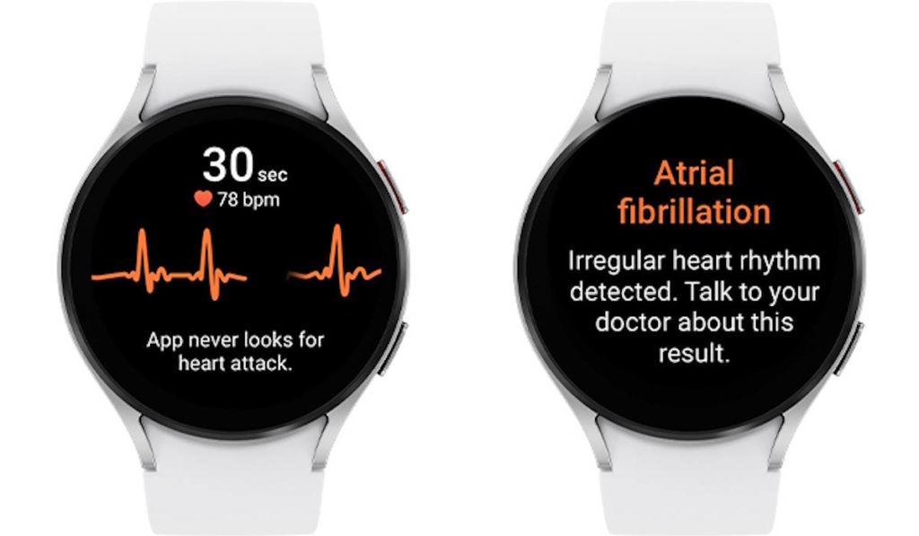 Samsung Galaxy Watch Notification ECG de rythme cardiaque irrégulier