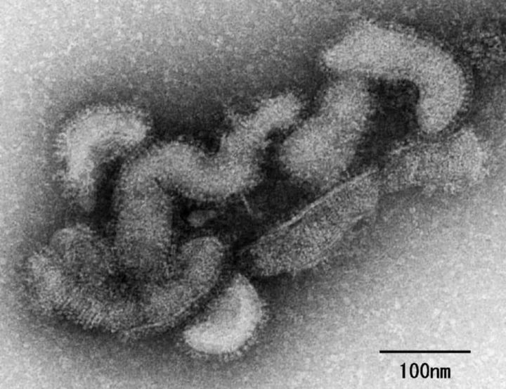 Image microscopique du virus Oz trouvé chez le patient décédé l'année dernière au Japon.  Image : Institut national des maladies infectieuses |  Source : The Japan Times