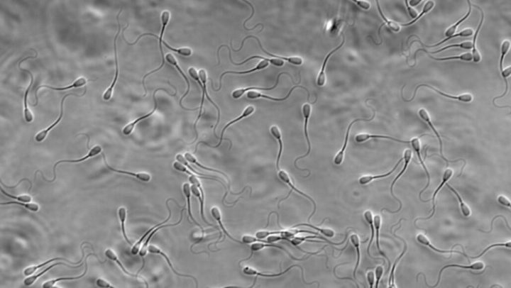 SpermSearch : comment l'IA peut aider les hommes infertiles à devenir pères 4 spermatozoïdes