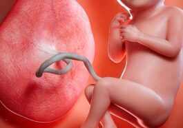 Placenta e bebé