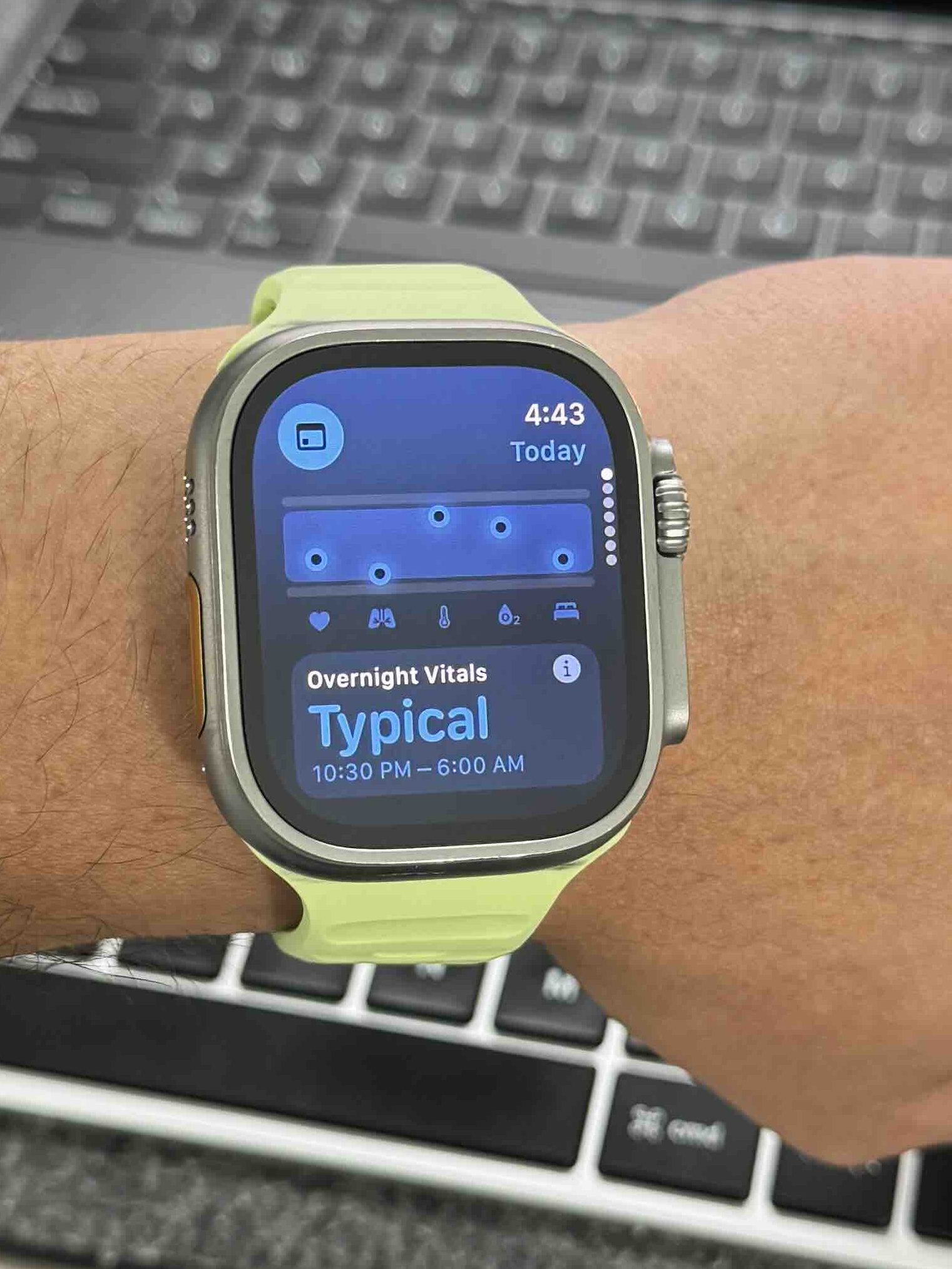 1723044610 644 Mes fonctionnalites preferees a venir sur watchOS 11 cette annee