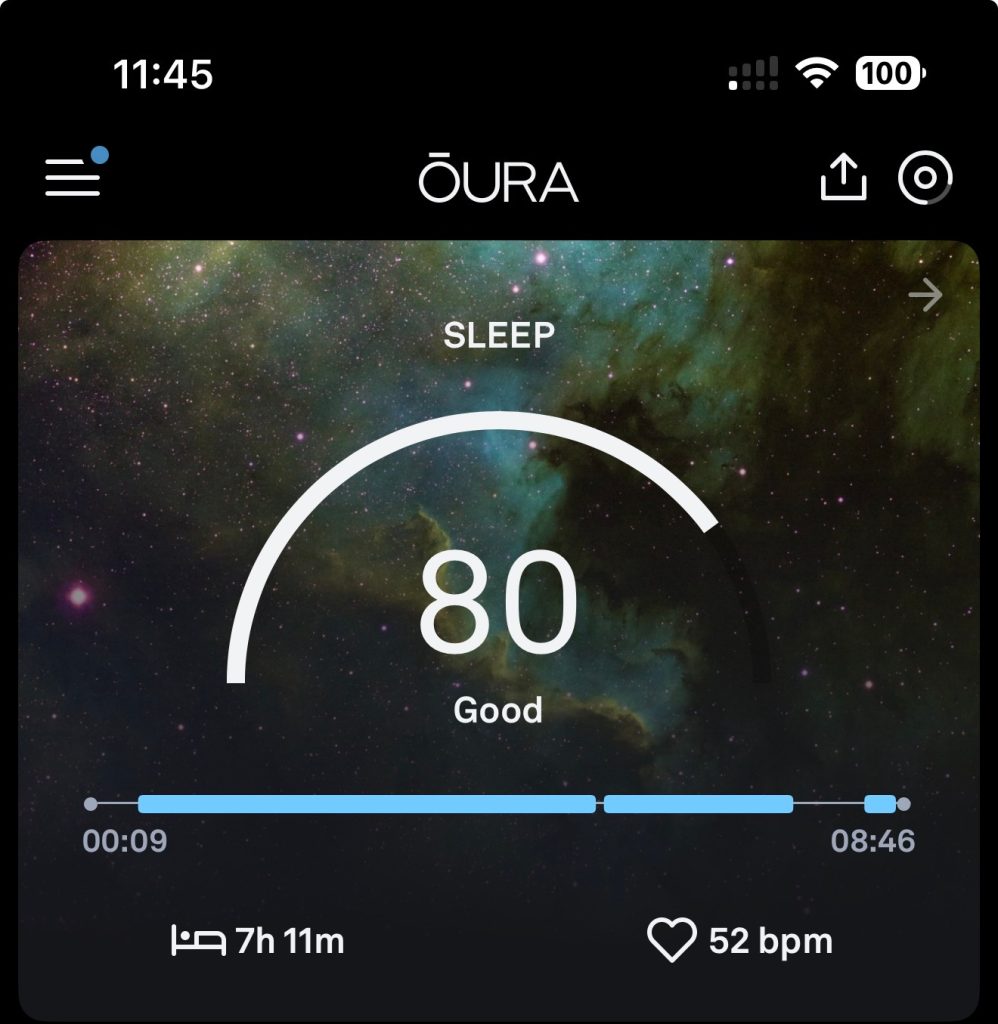 Apple Watch : le score de sommeil inspiré de ces deux fonctionnalités de smart rings 4 1753269944 256 Apple Watch le score de sommeil inspire de ces